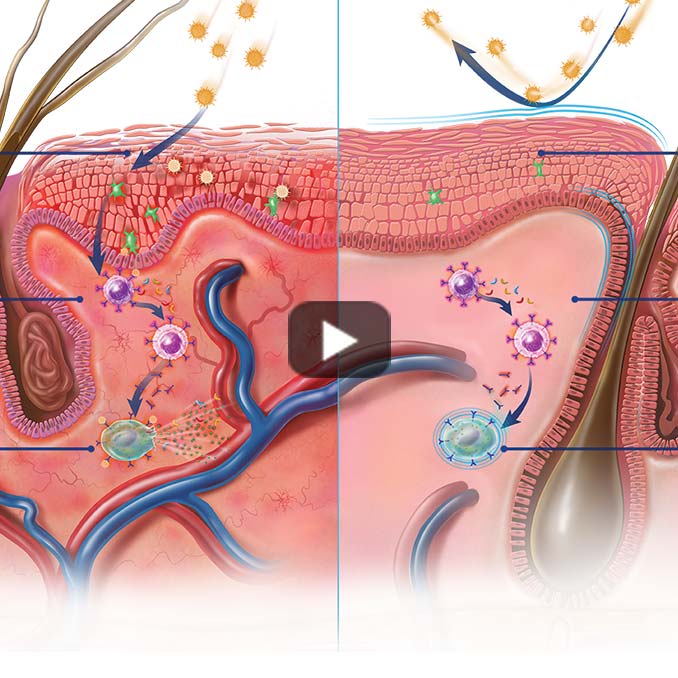 HV_derm_video_seehowitworks